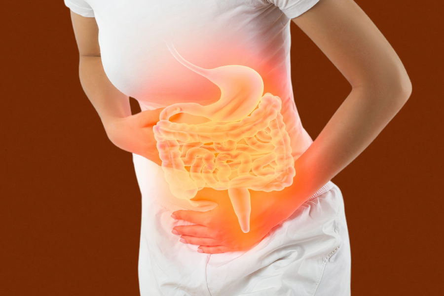Doença inflamatória intestinal: você sabe o que é?